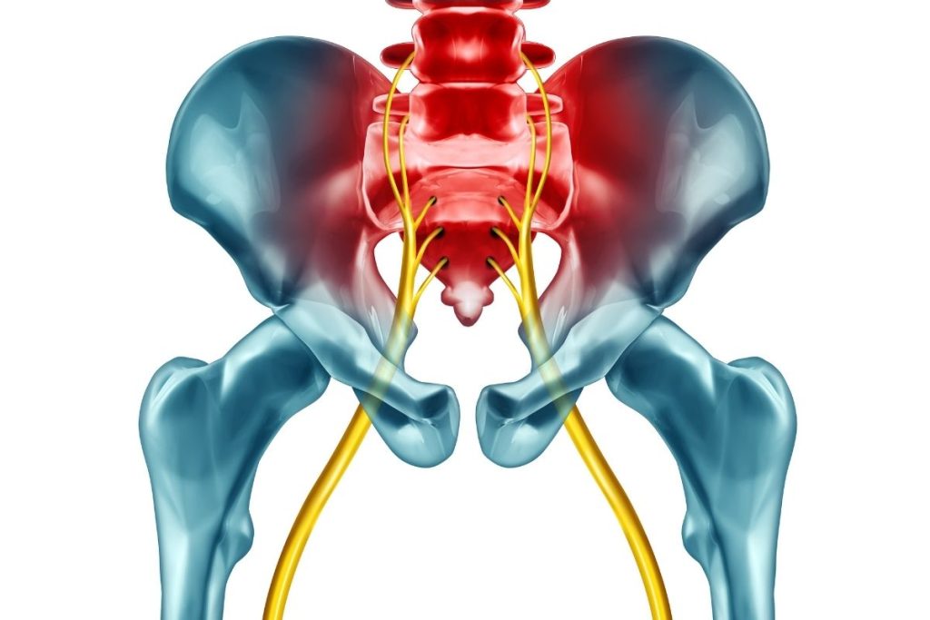Sciatica3