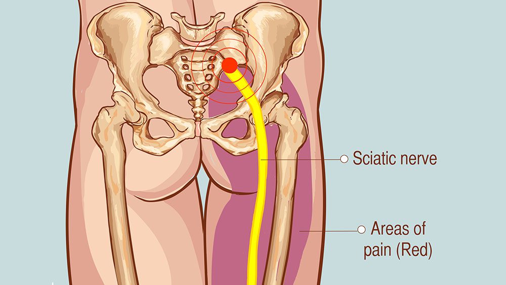 sciatic nerve