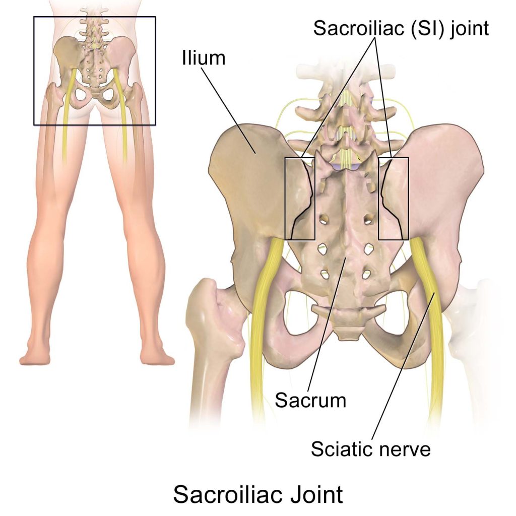 sciatic nerve pain owens chiropractic federal way wa